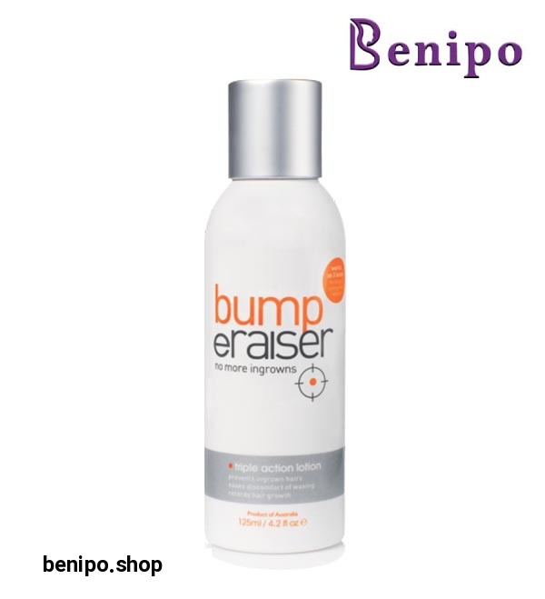 لوسیون 3 کاره درمان موهای زیر پوستی