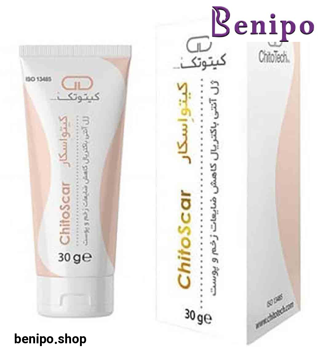 کیتو اسکار 30 میل