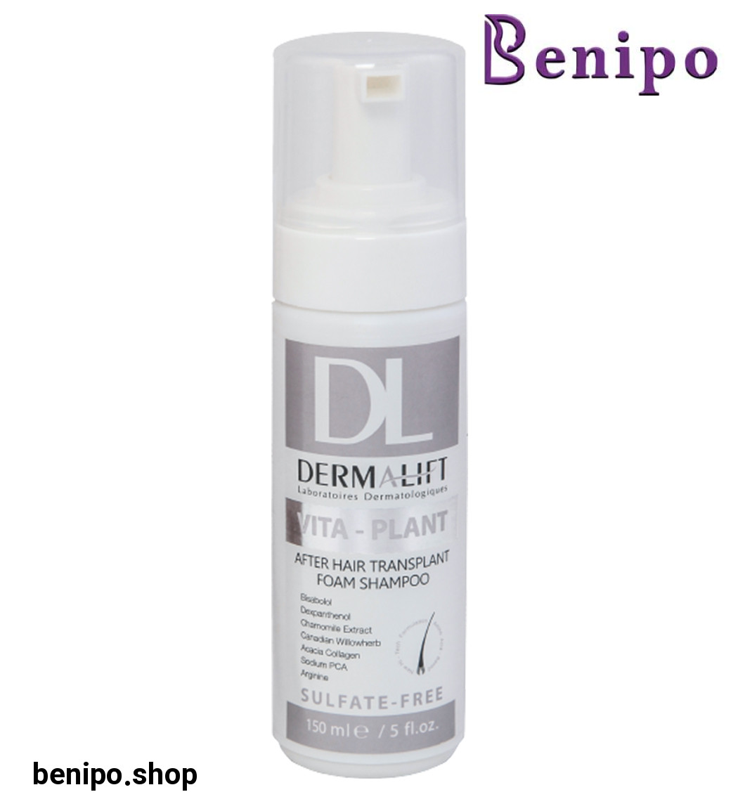 شامپو فوم بعد از کاشت مو مناسب موهای کاشته شده ویتاپلنت 150میل