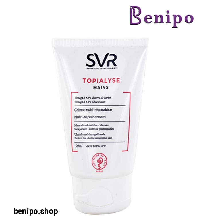 كرم دست توپياليز